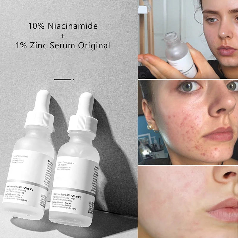 Original Niacinamide High Vitamin Mineral Formula Essence Long Lasting Moisturizing Serum Salicylic Acid Skincare Products