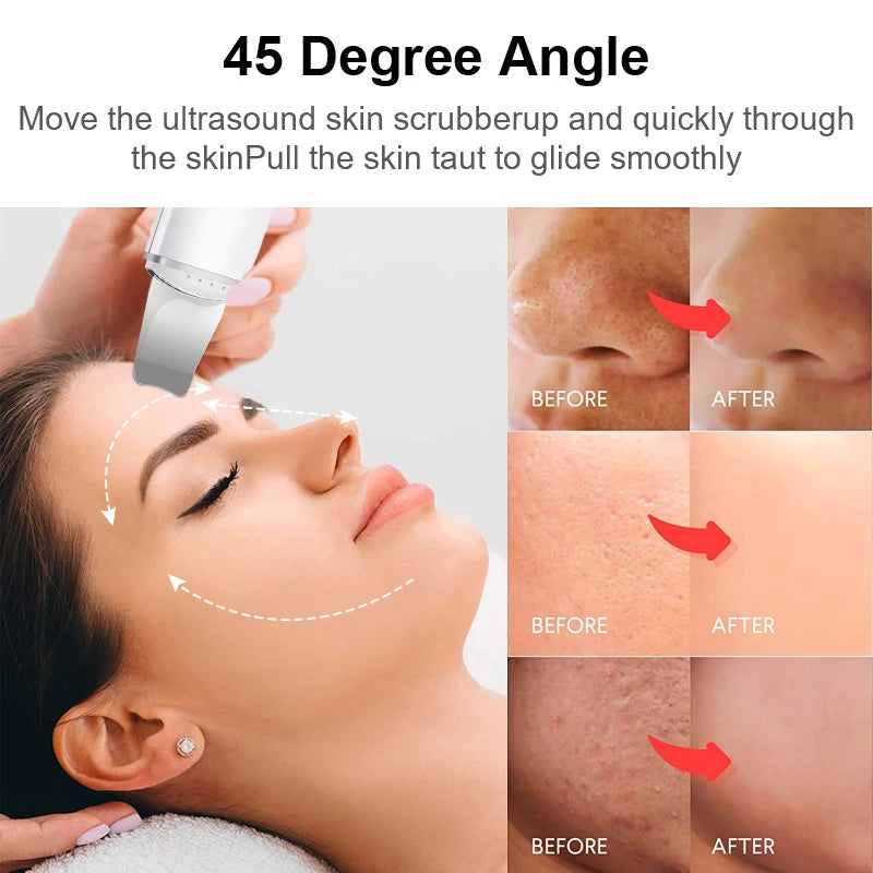 Ultrasonic facial skin cleaning device